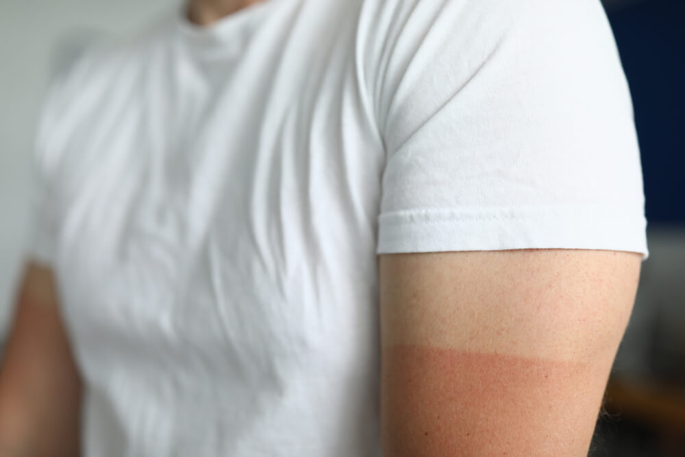 Close-up,Of,Man,Wearing,White,Shirt,With,Red,Mark,Of